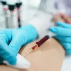 Ręka w niebieskiej rękawiczce pobiera krew do strzykawki. Czy to felczer? Kto to?